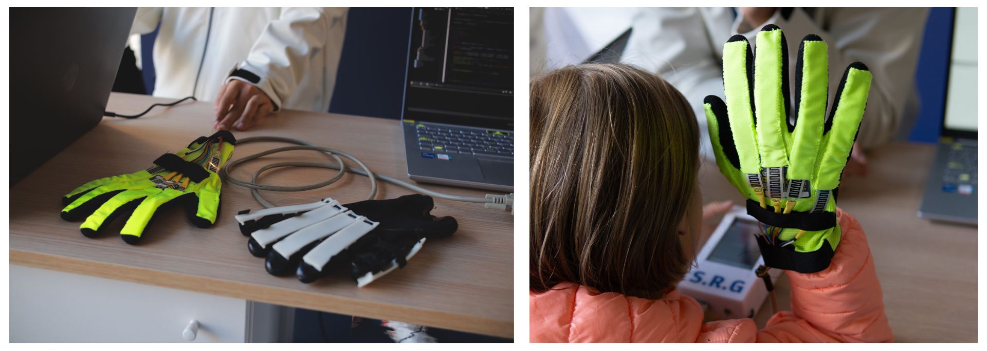 The Smart Rehabilitation Glove 