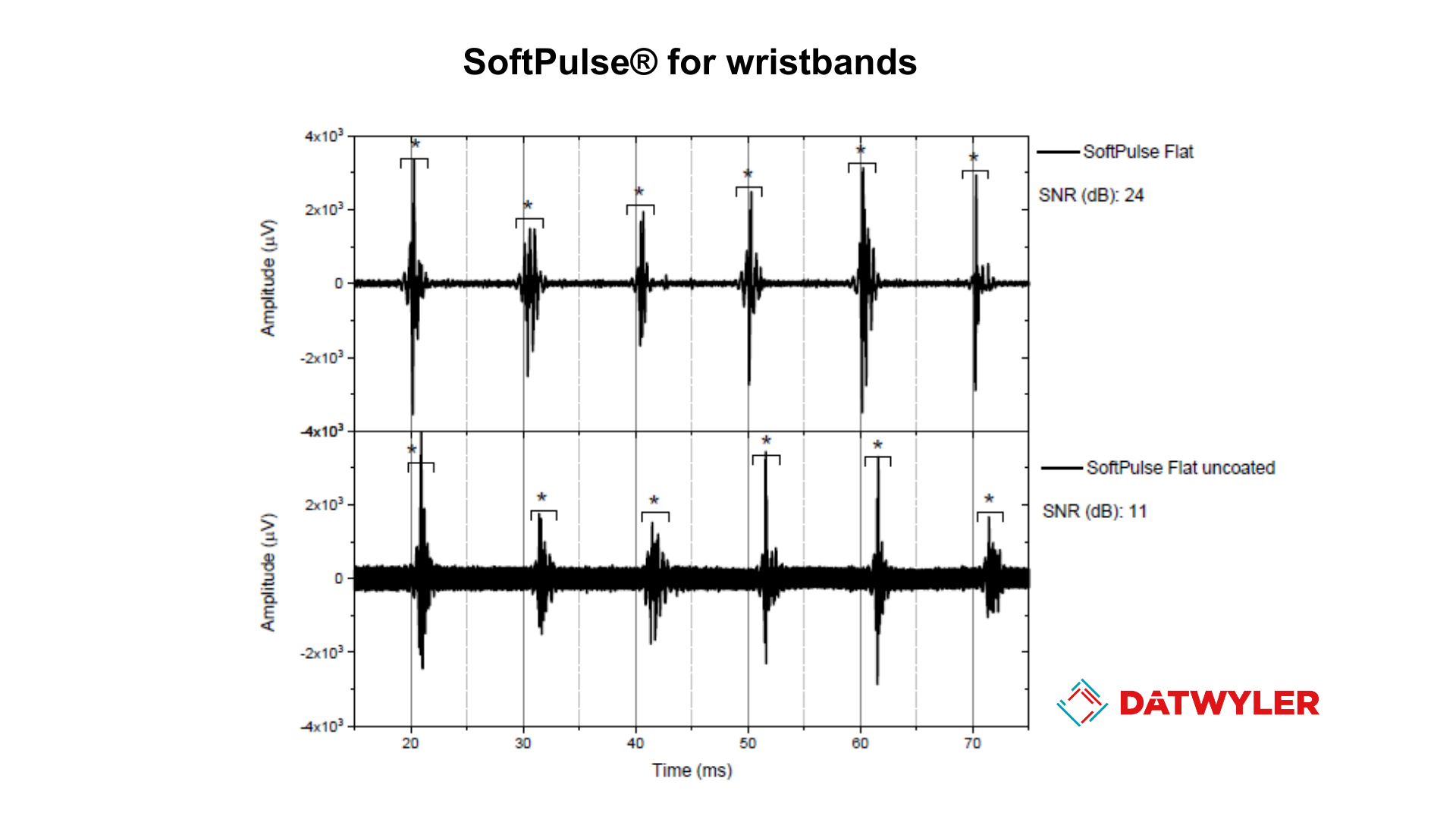 SoftPulse® electrodes can be reliably used to detect EMG from different body locations